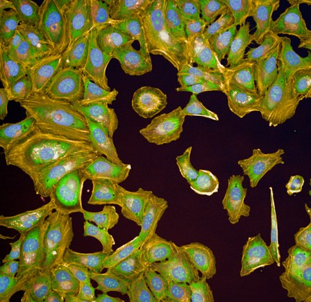 The “Cell Painting” method allows scientists to visualize cell changes upon chemical exposure.