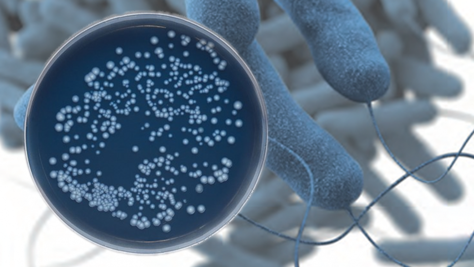 Back photo is a microscopic image of Legionella (CDC) and the front image is an agar plate with Legionella growth (EPA)