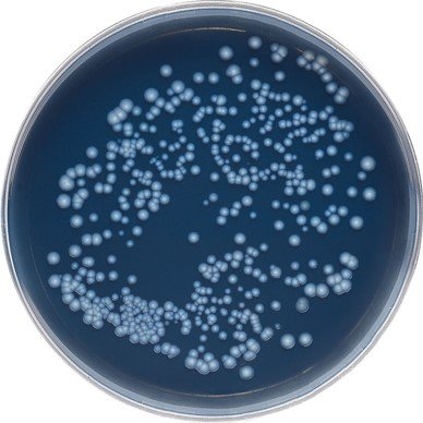 Legionella on petri dish