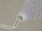 Magnified mold and mold spores