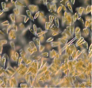 Diatoms