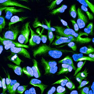 Neuronal cell imagery showing nuclei in blue and nestin in green.